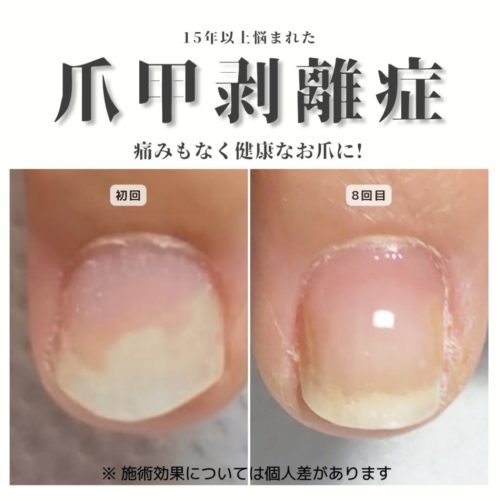 04-1　剥離　育成前・結果